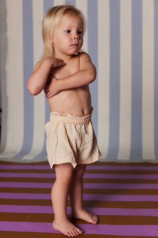 Toddler standing with lotion smeared on chest and abdomen, wearing beige shorts against striped backdrop.