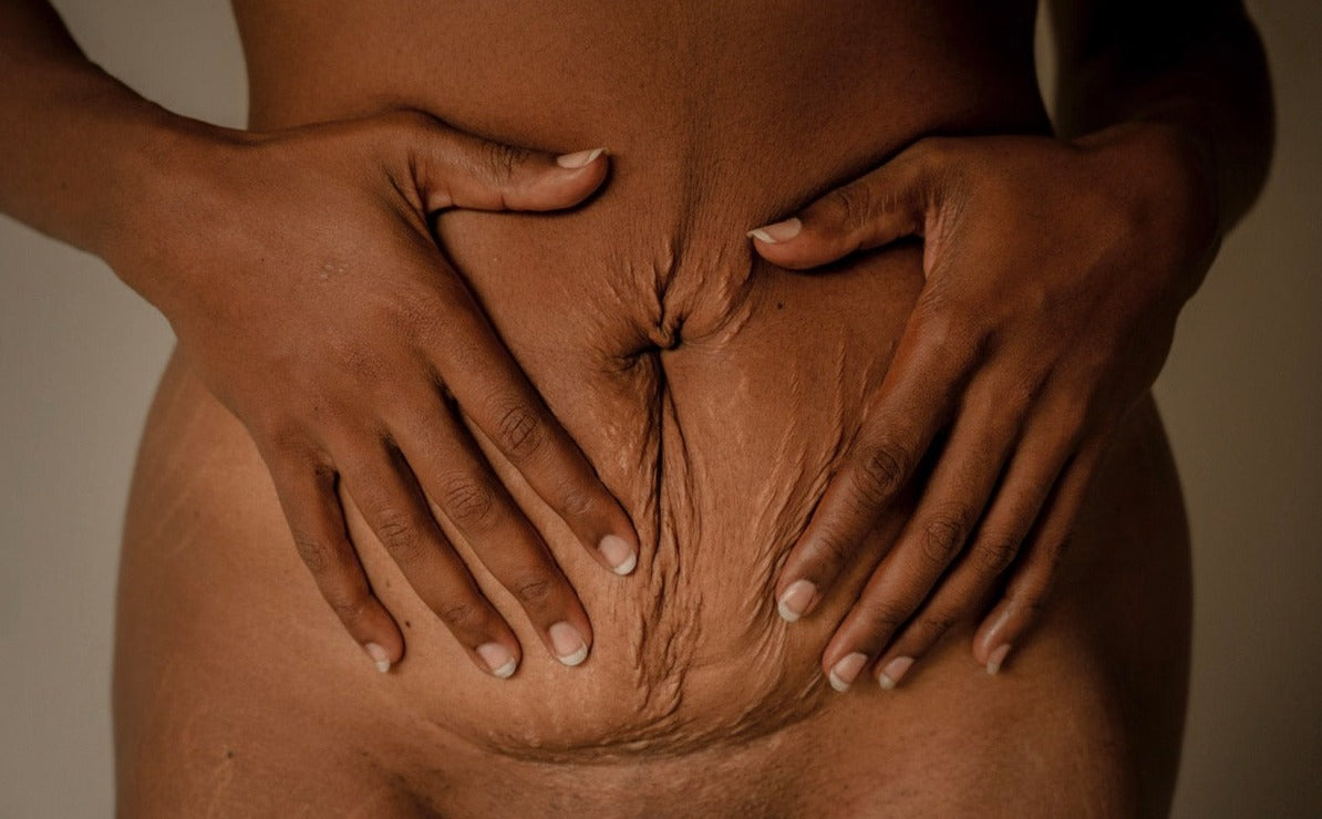 a pregnant woman is showing her loose belly after 