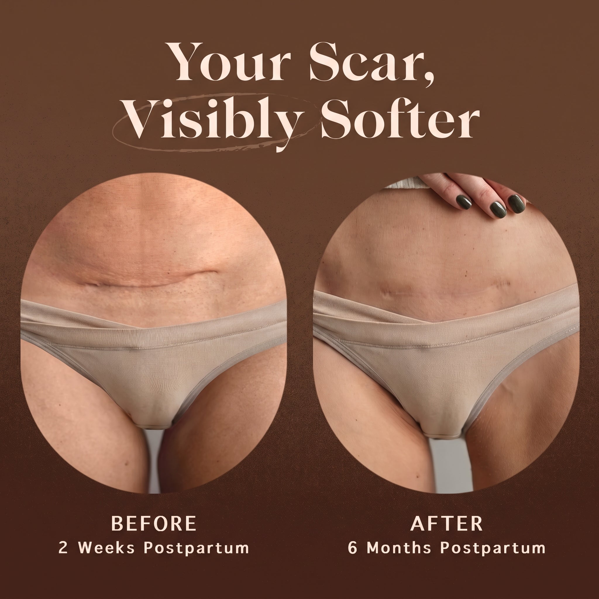 Renewing Scar Cream