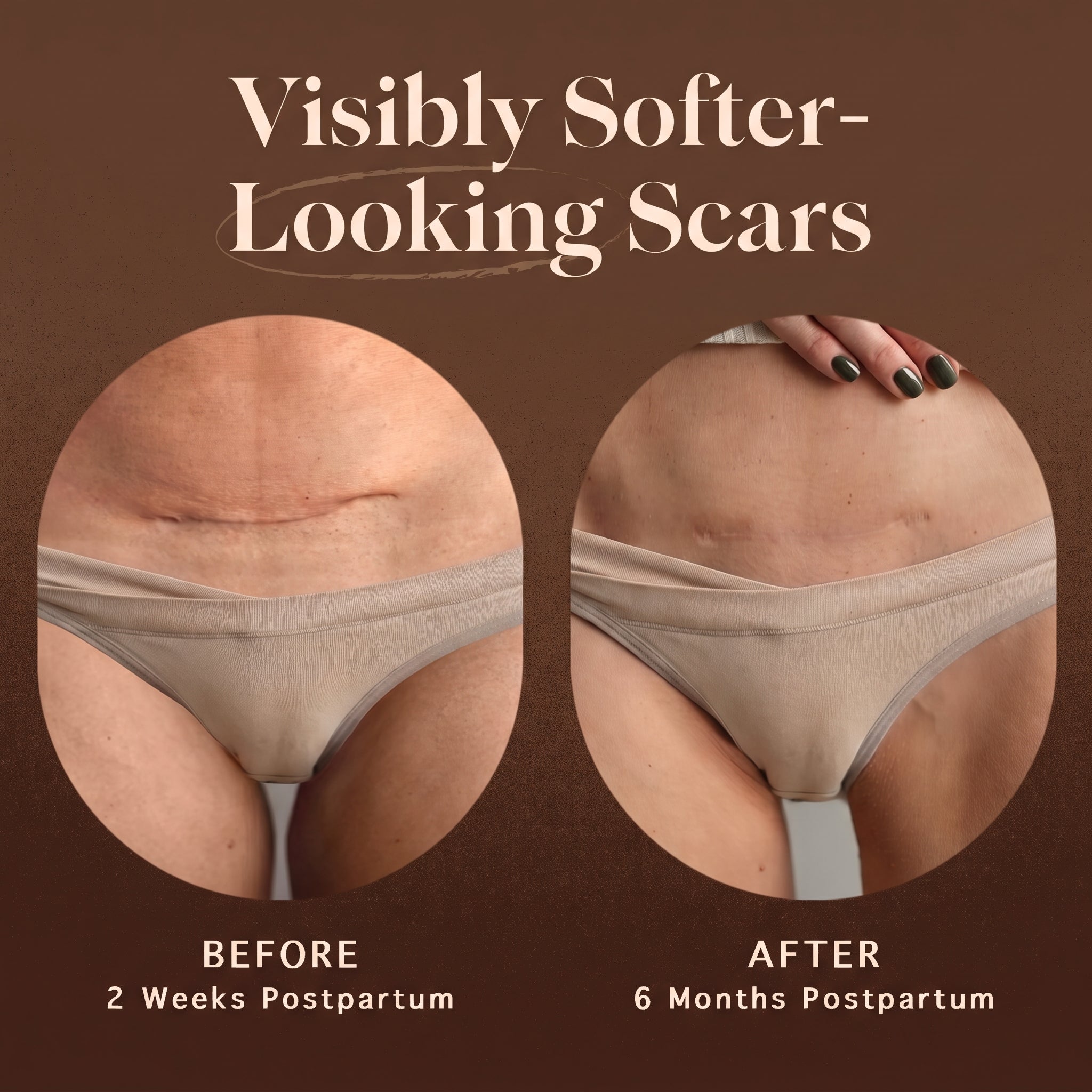 Renewing Scar Cream