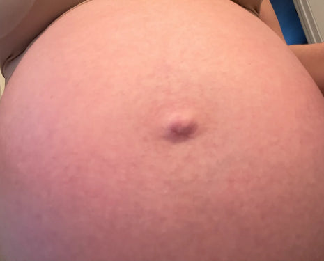 picture of a pregnant belly